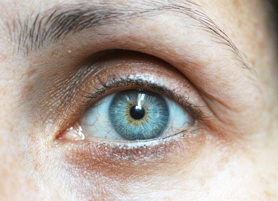 How Do Celebrities Tackle Dry Eyes